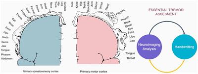 Analysis of Fine Motor Skills in Essential Tremor: Combining Neuroimaging and Handwriting Biomarkers for Early Management